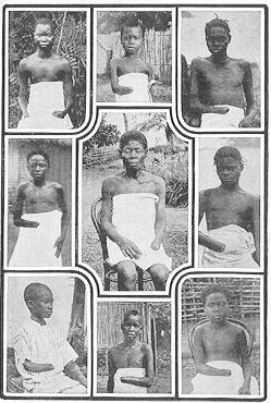 victims of king leopold of belgium